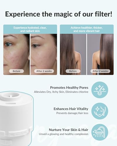 Shower Filter for SANYCASA Beauty Shower Head