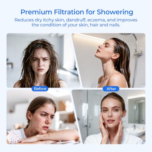 R24162 NA Showerhead Filter Replacement