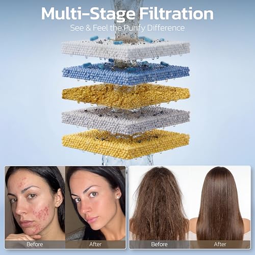 6 Setting Filtered Handheld Shower Head