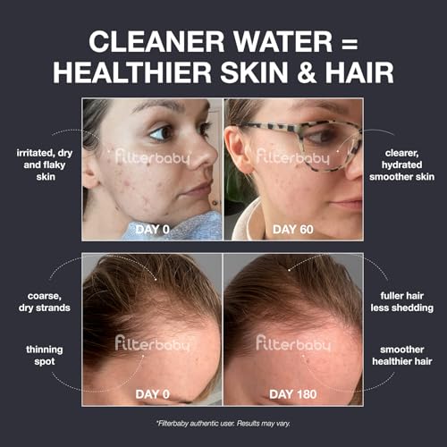 Diamond Shower Filter for Skin & Hair