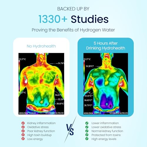 Hydrogen Water Bottle for Kidney