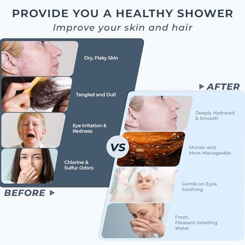 2026 Magnetic Filtered Shower Head with Handheld