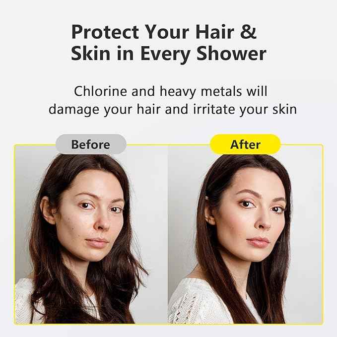 Next-Gen Shower Filter - SoliCozy Shower Water Filter, Water Softener Shower Head Filter, Reduces Dry Itchy Skin, Dandruff, Eczema, and Dramatically Improves The Condition of Your Skin, Hair and Nails