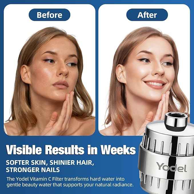 Yodel Shower Filter for Hard Water - 25 Stage Shower Head Filter Removes Chlorine for Hair and Skin, Reduces Dry Skin, Dandruff and Hair Damage, Universal High Output Water Filter,Chrome