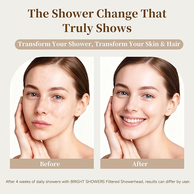 BRIGHT SHOWERS Filtered Shower Head, High Pressure Fixed Showerhead for Hard Water, Dual-Media Filter Removes Chlorine & Impurities, 8 Spray Modes, Oil Rubbed Bronze