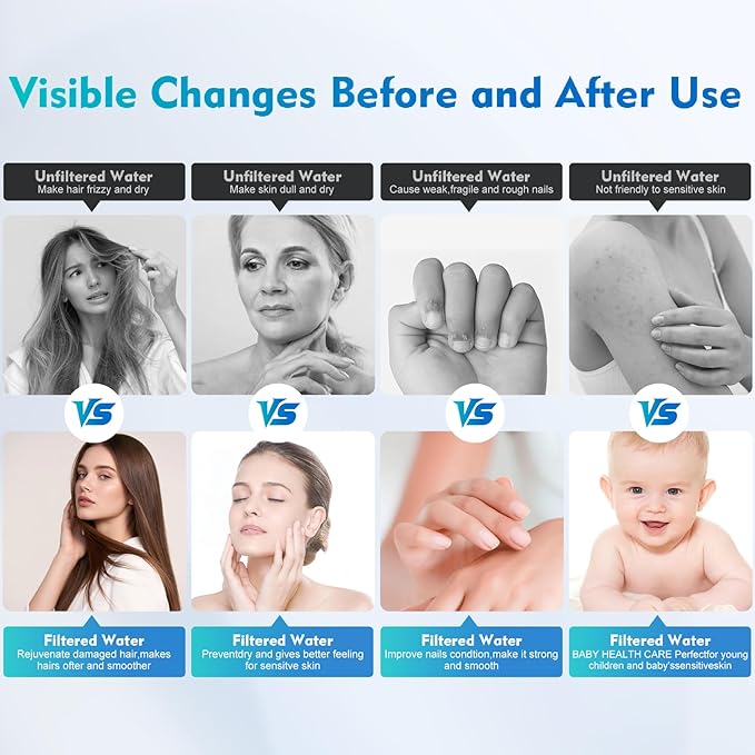 Filtered Shower Head with 5 Cartridges Vitamin C+E+A for Healthy Skin & Hair, Removes Chlorine, Heavy Metals & Harmful Substances, Water Softene