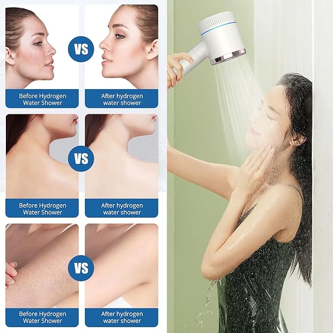 Hydrogen Generator Shower Head – High Pressure Handheld with Vitamin C Filter, Water Softener, Aromatherapy – Removes Chlorine, Hydrates Skin & Hair – 1200ppb Hydrogen