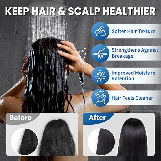 IceJoy Filtered Shower Head - Scientifically Evaluated, High-Efficiency Shower Head with Filters for Enhanced Hair & Skin Health, Minimize Hair Loss, Preserve Color-Treated Hair(Matt Black)