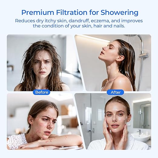 R24162-NA Showerhead Filter Replacement, Compatible with Kohler Aquifer Filtered Showerhead R24670 or Kohler Aquifer Shower Filter R24612, 2 Pack