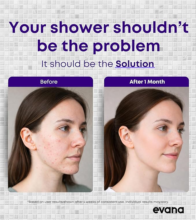 Evana Filtered Shower Head with Filters - Removes up to 99% Chlorine & Heavy Metals - High Pressure Shower Heads – Bathroom Accessories - Shower Filter - Rain Shower Head Filters - Chrome Showerhead